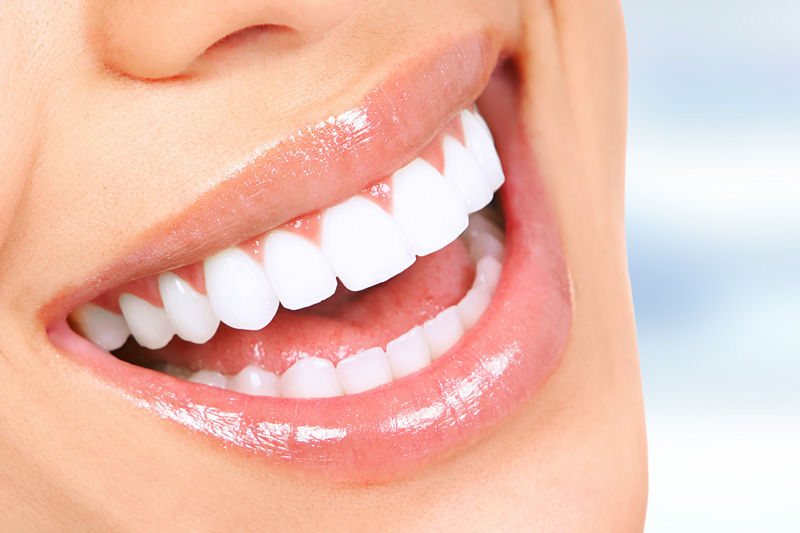 Cosmetic Dentistry in Miami